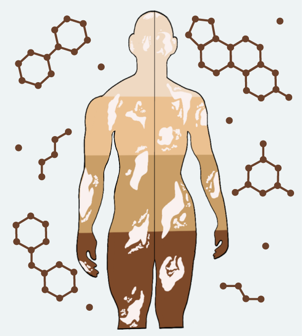 ViCEKb | Vitiligo-linked Chemical Exposome Knowledgebase